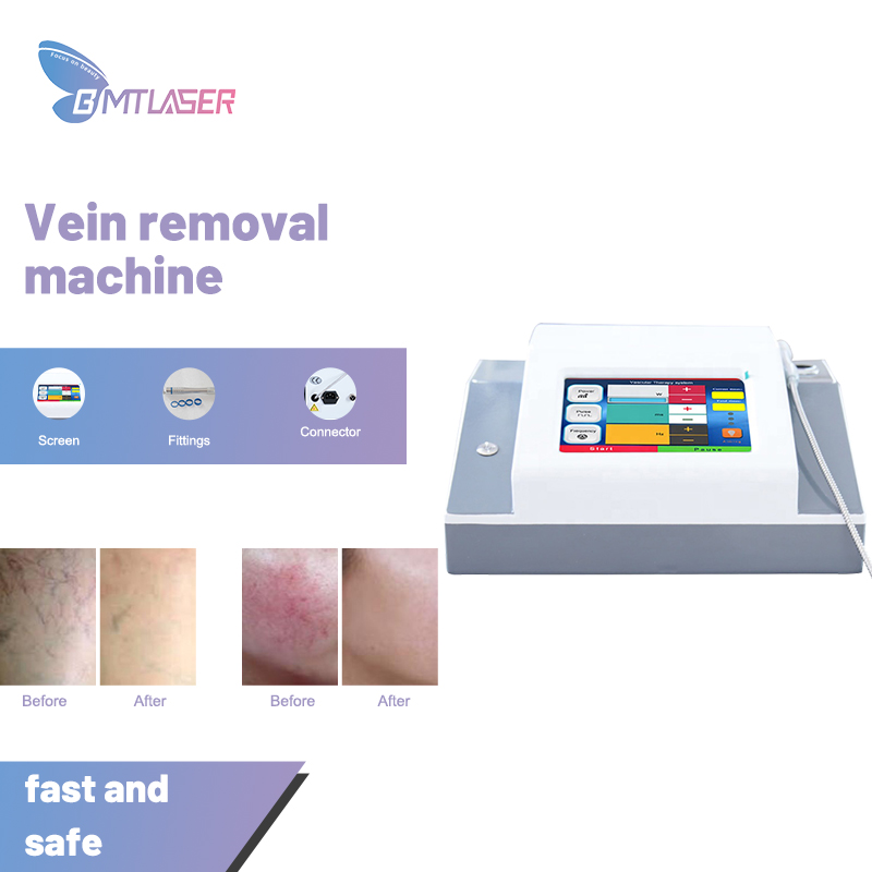Dark Spot Removal 980 Nm Diode Laser for Vascular Removal Buy dark
