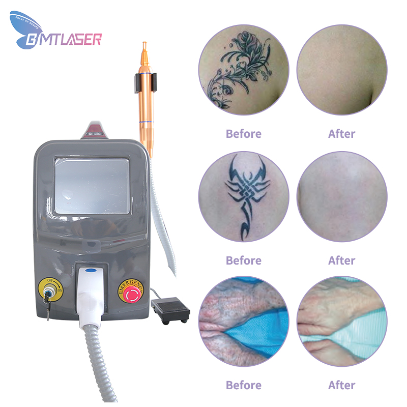 Tattoo Removal Picosure Laser Hyperpigmentation Removal Machine Buy