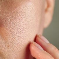 Shrink pores