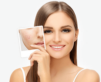 Scars treatment